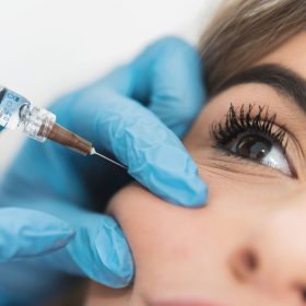 Elmacik Kemigi Dolgusu