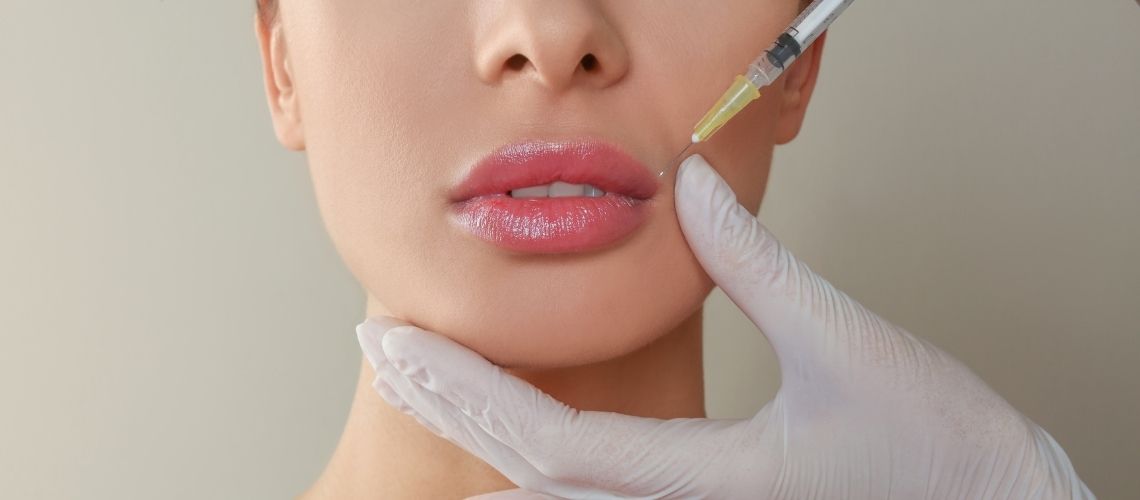 Dudak Dolgusu Ne Kadar Kalıcı Oluyor? 2 Dudak Dolgusu Ne Kadar Kalici Oluyor