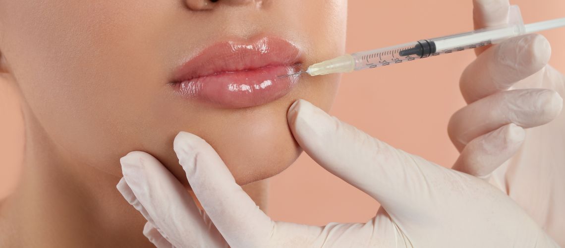 Dudak Dolgusu Sonrası Ödem ve Şişlik 1 Dudak Dolgusu Sonrasi Odem ve Sislik